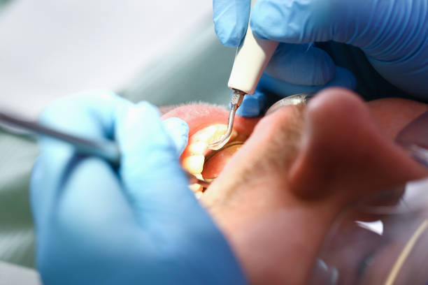 Best Urgent Dental Care for Toothaches in Weatherford, OK
