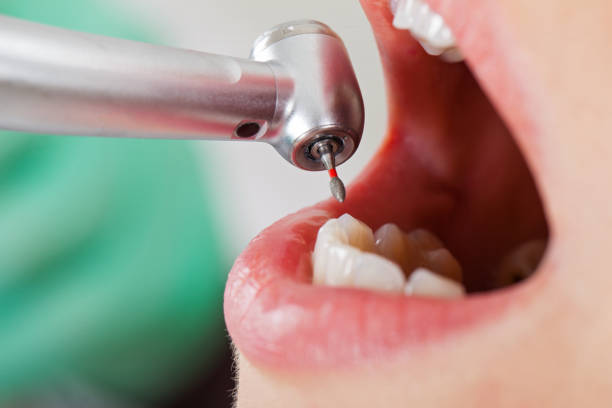 Best Weekend Emergency Dental Services in Weatherford, OK